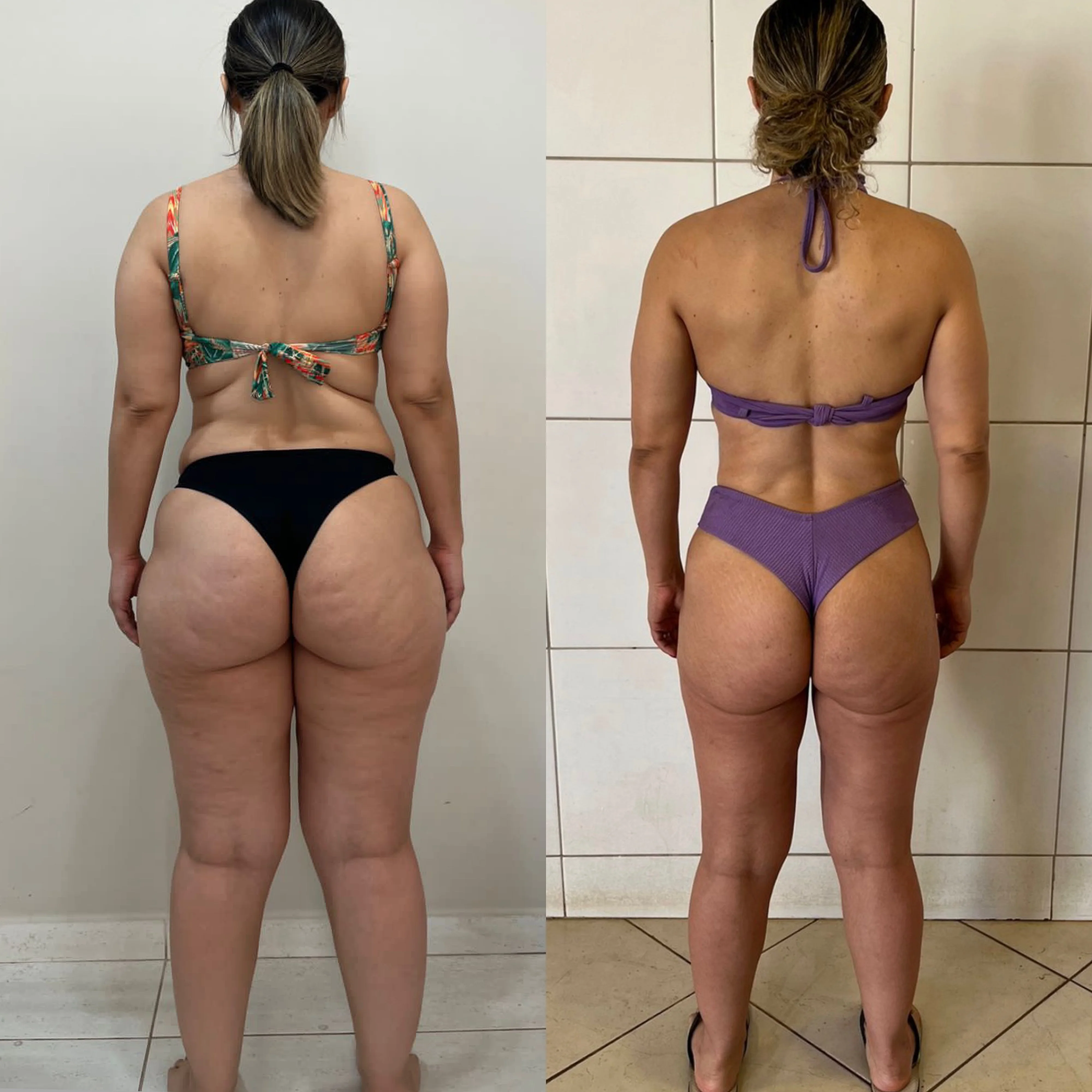 Antes e depois — redução de gordura e tônus muscular de aluna